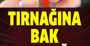 Tırnağına bak hastalığı anla