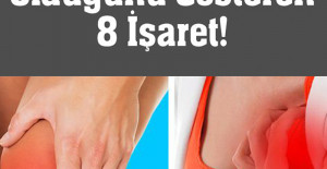 Vücudunuzda folik asidin düşük olduğunu gösteren 8 işaret	