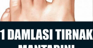 Basit Bir Yöntemle Tırnak Mantarından Kurtulun	