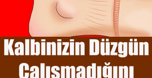 Kalbinizin Düzgün Çalışmadığını Gösteren Belirtiler