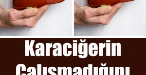 Karaciğerin Çalışmadığına Dair 12 Belirti