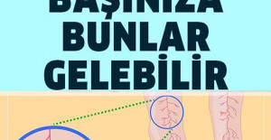 Vücudunuzda Magnezyum Eksikliğinin 13 Belirtisi