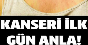 Hastalığına Ait İlk Belirtiler Nelerdir	