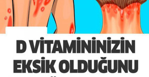 D Vitamini Eksikliğiniz Olduğunu Gösteren 10 Belirgin İşaret