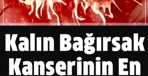 Kalın Bağırsak Kanserinin En Büyük Bulgusu