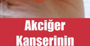 Akciğer Kanserinin En Sinsi 9 Belirtisi