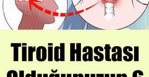 Tiroid Hastası Olduğunuzun 6 Gizli İşareti
