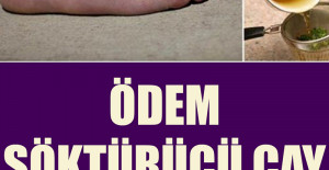 Ödem Söktürücü Çay Tarifi