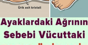 Ayaklardaki Ağrının Sebebi Ürik Asit Olabilir