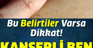 Bu Belirtiler Varsa Dikkat Nasıl Anlaşılır	