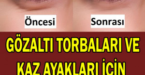 Gözaltı torbaları nasıl geçer