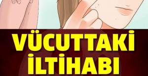 Vücuttaki İltihabı Yok Eden Bitki