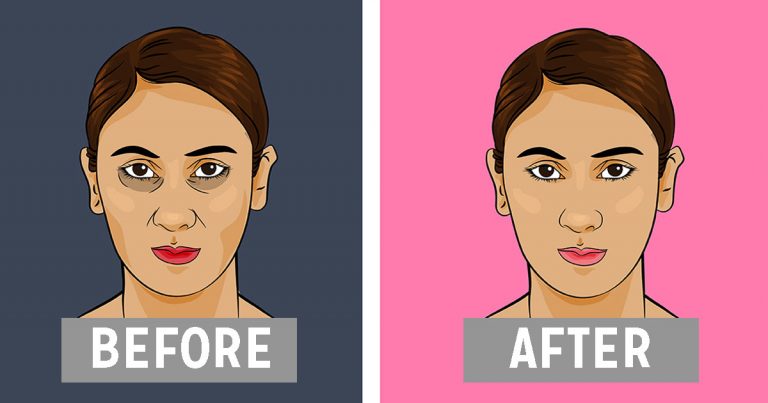 Gözaltı torbaları nasıl geçer - 2