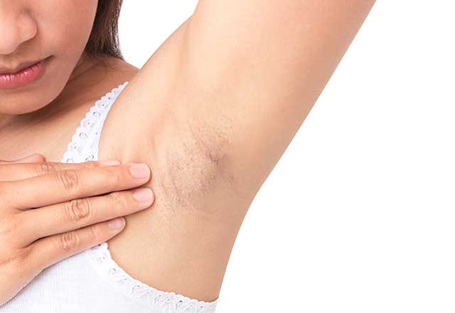 İnsanların umursamadığı erken bulguları - 2