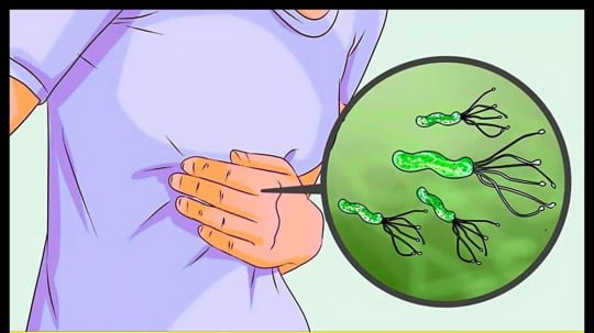 Mideden Bakterileri Ortadan Kaldırmanın Doğal Yöntemi - 4