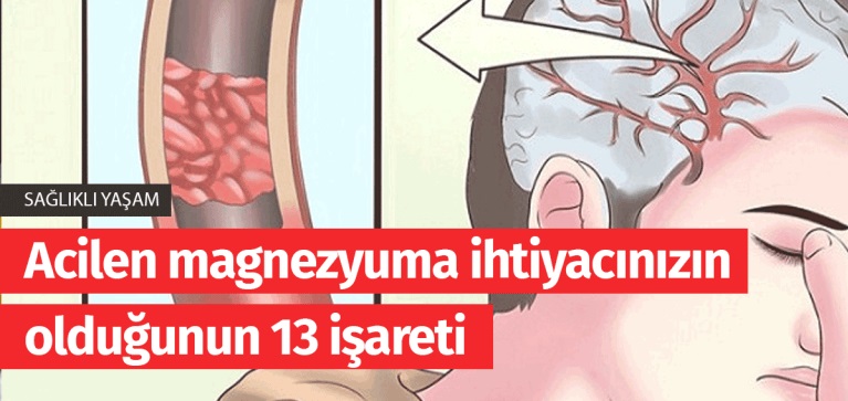 Acilen Magnezyuma Lüzumunuzun Olduğunun 13 İşareti - 5