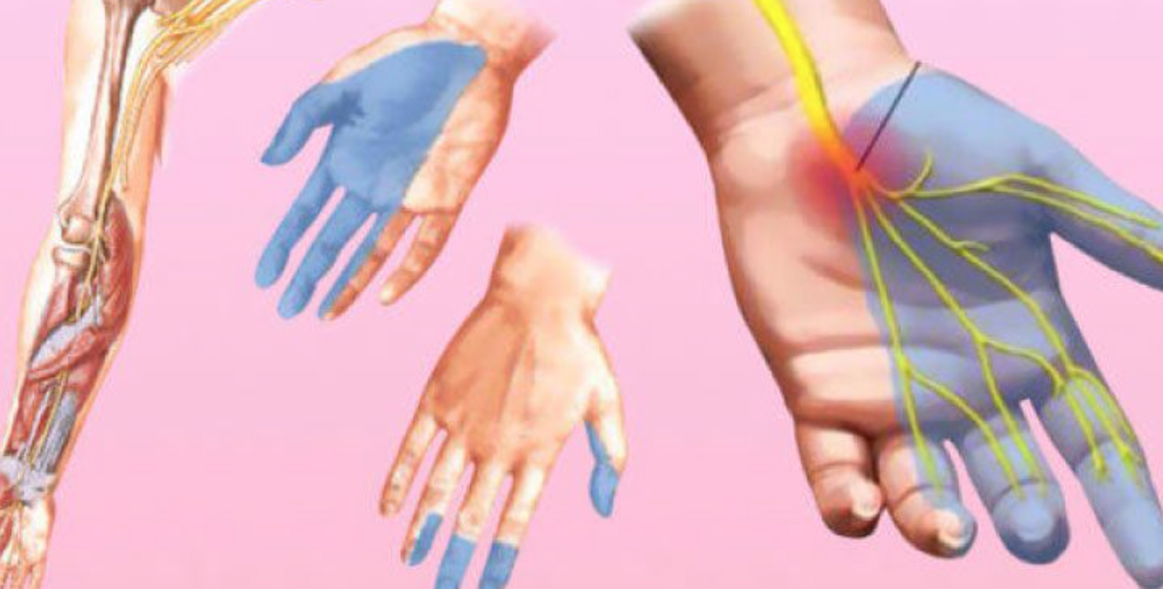 El ve ayak uyuşması neyin belirtisi - 5