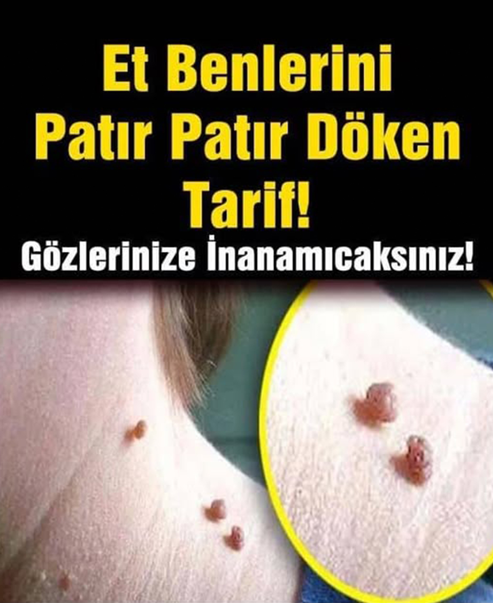 Et Benlerinizi Patır Patır Döken Tarif - 1