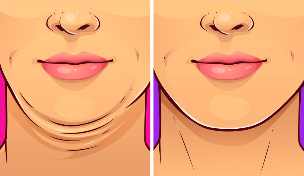 Harfiyen Uyguladım Gıdım Yok Oldu - 3