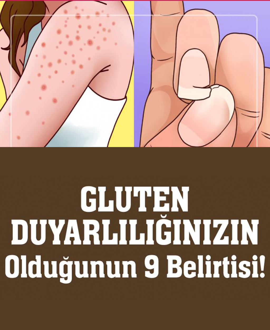 Gluten Duyarlılığınızın Olduğunun 9 Belirtisi - 1