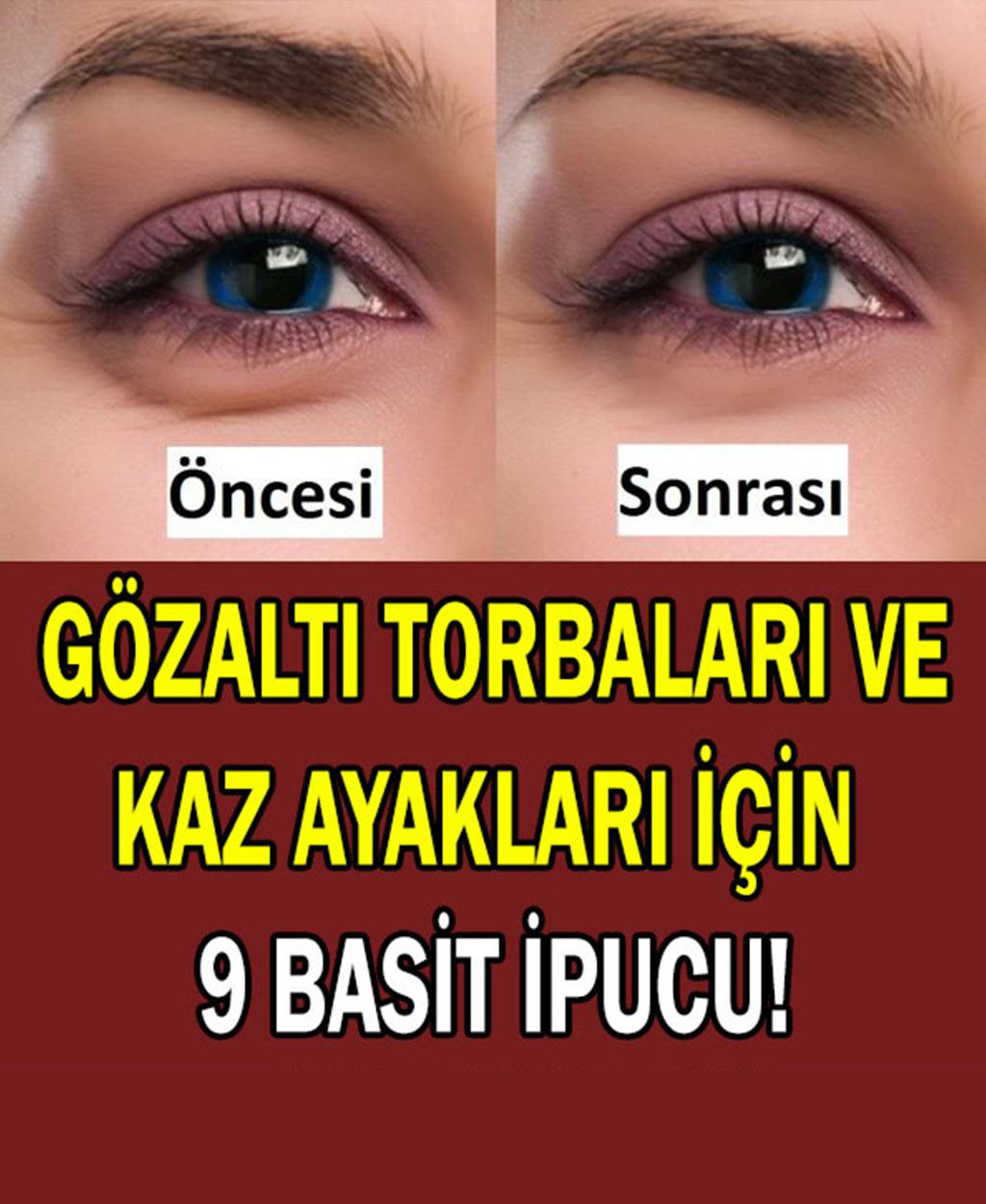 Gözaltı torbaları nasıl geçer - 1