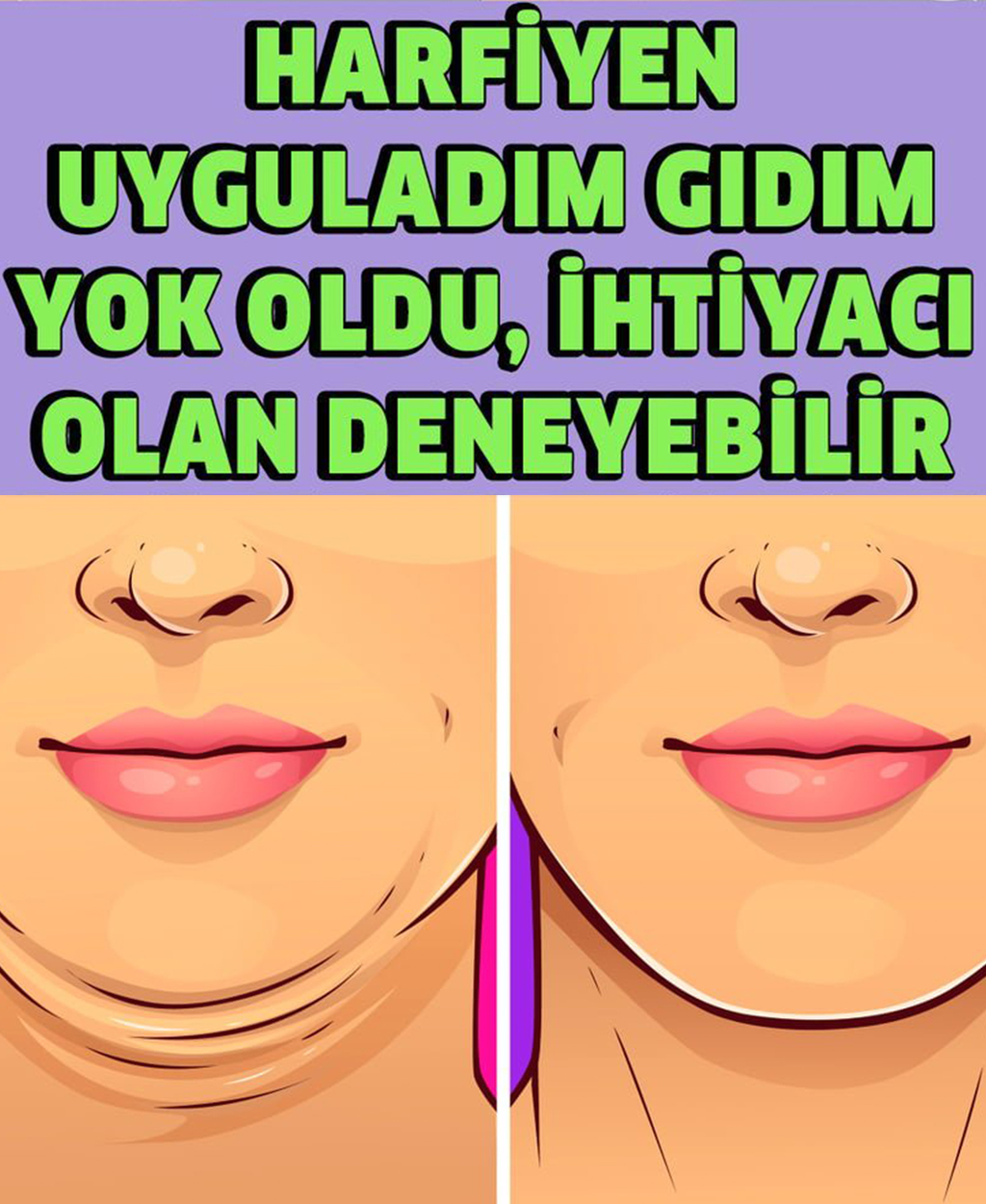 Harfiyen Uyguladım Gıdım Yok Oldu - 1