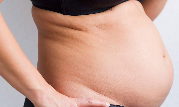 Yumurtalık Kanserinin En Önemli Belirtisini Biliyor Musunuz? - 3