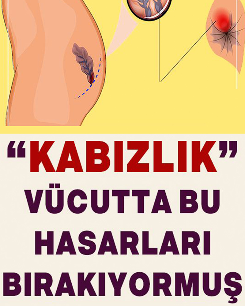 Kabızlık vücutta bu hasarları bırakıyormuş - 1