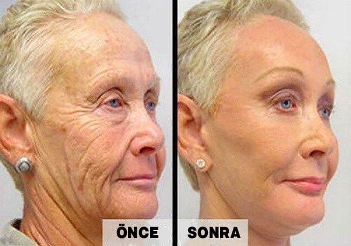 Her Sabah Yüzünüzü Bu 2 Malzemeli Karışımla Yıkayın - 4
