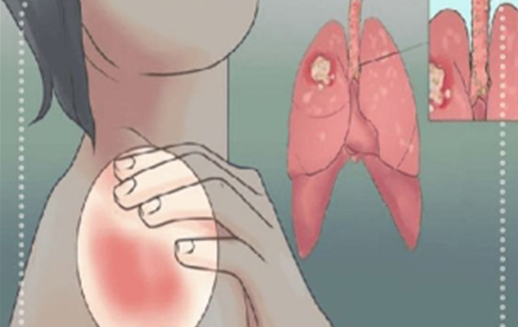 Kadınlarda belirtileri nelerdir - 2