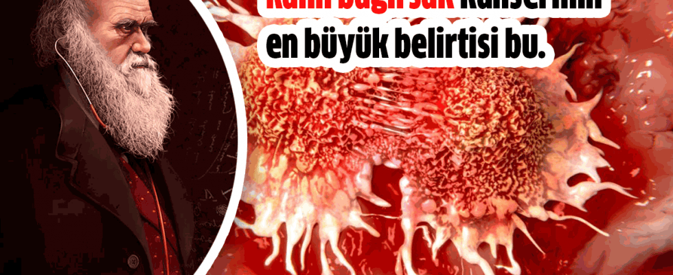 Kalın Bağırsak Kanserinin En Büyük Belirtisi Bu - 4