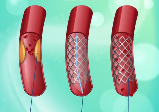 Damarlarınızı Tertemiz Yapacak Sır - 2