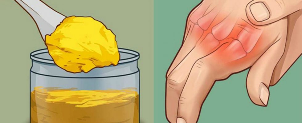 Kemikleri Yeniden Doğmuş Gibi Yapıyor - 2