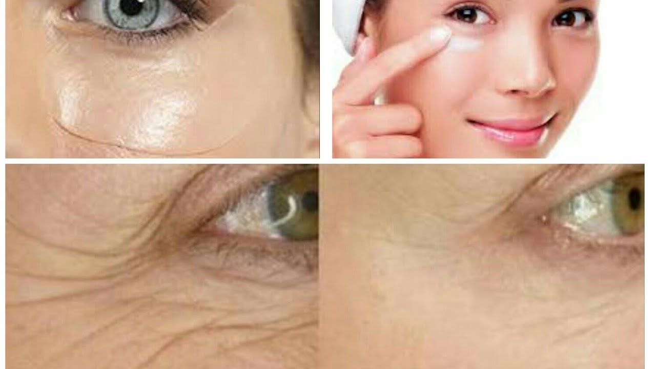 Gözaltı torbaları nasıl geçer - 3