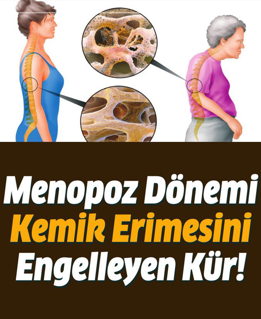 Menopoz Dönemi Kemik Erimesini Engelleyen Kür - 1