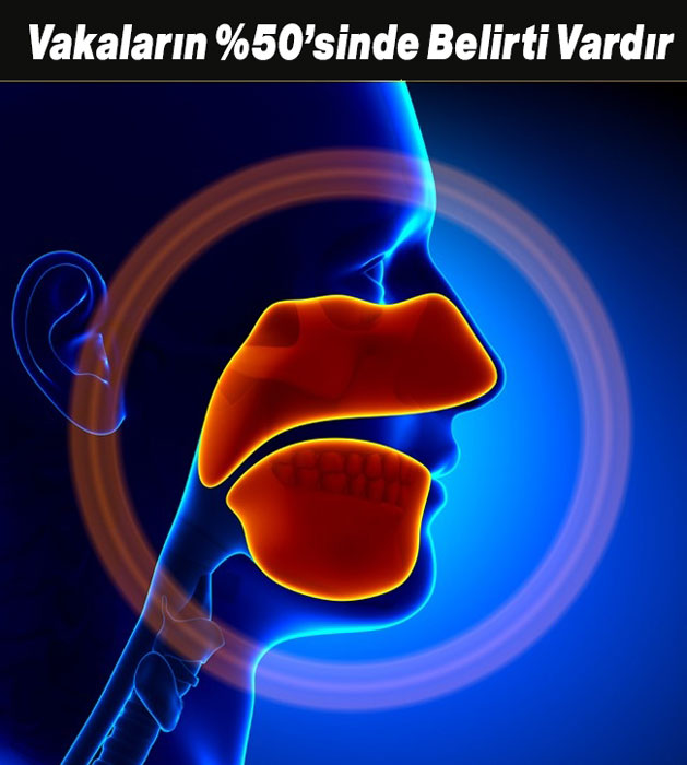 Kalp Krizinden 1 Ay Önce Kalbiniz Sizi 8 Şekilde Uyarı - 5