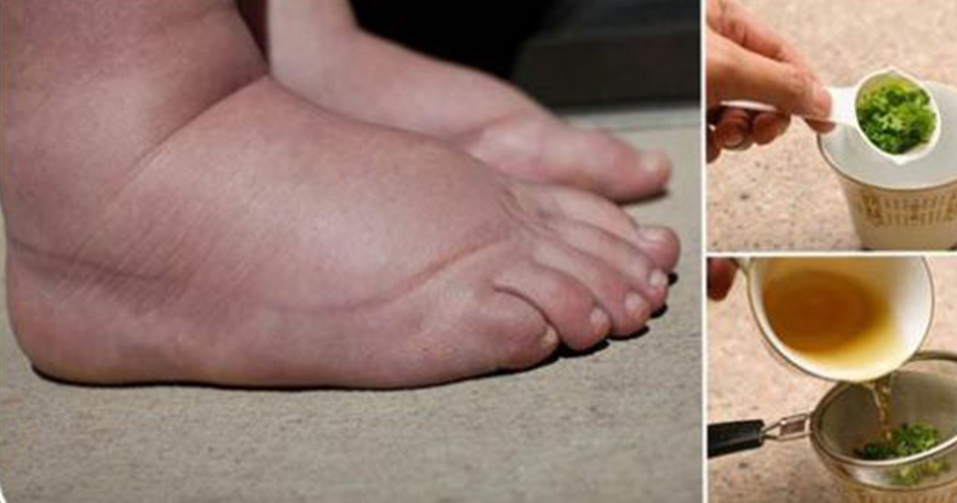 Ödem Söktürücü Çay Tarifi - 4