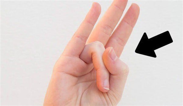 Başparmağınızla Yüzük Parmağınızı Birkaç Saniyeliğine Böyle Esnetin - 5