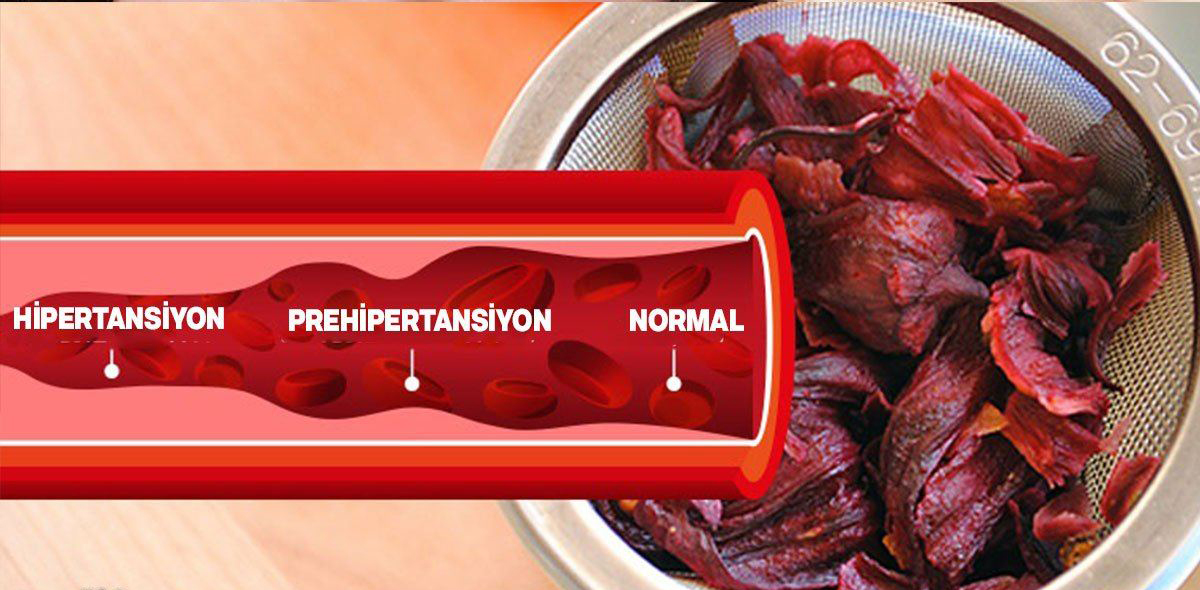 Tansiyonu Düşüren Baharatlar Herkes Bilmeli - 2