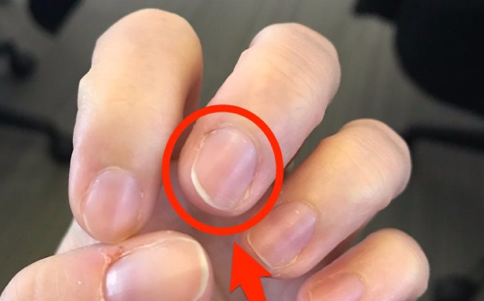 Tırnağına bak hastalığı anla - 3