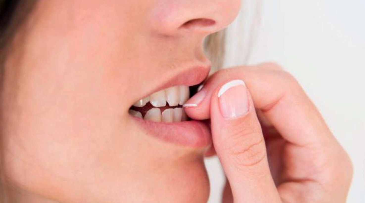 Tırnak yeme alışkanlığı nasıl bırakılır? - 3