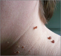 Et Benlerinizi Patır Patır Döken Tarif - 2