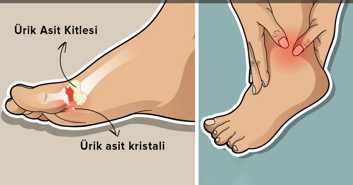 Vücuttaki Ürik Asidi Düşürebilecek 8 Besin - 2