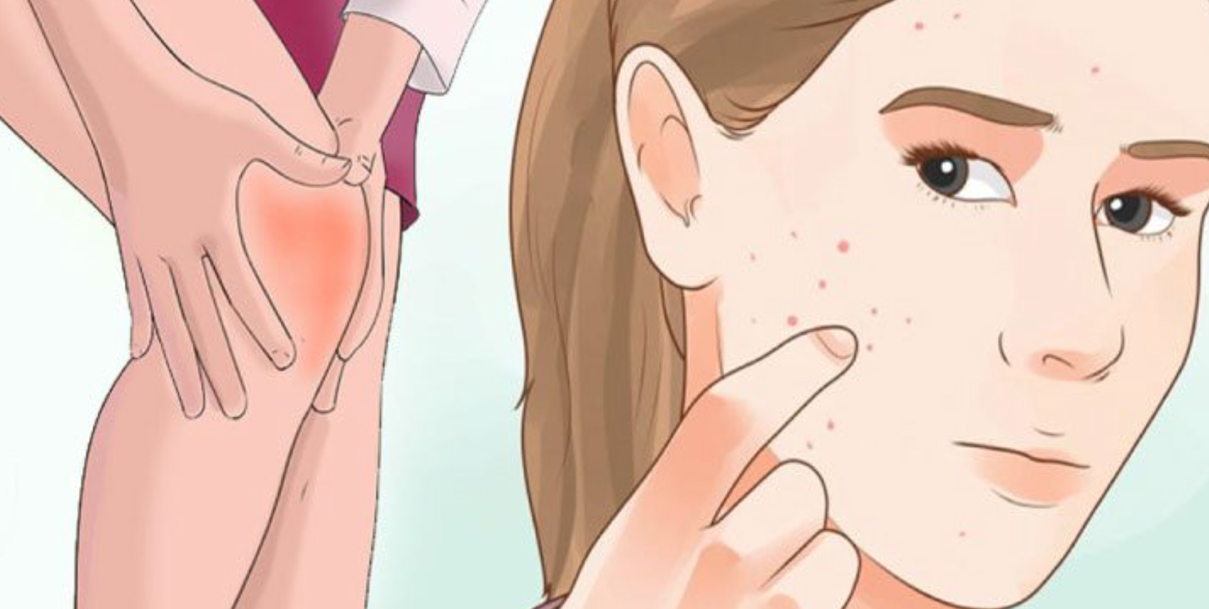 Vücuttaki İltihabı Yok Eden Bitki - 4