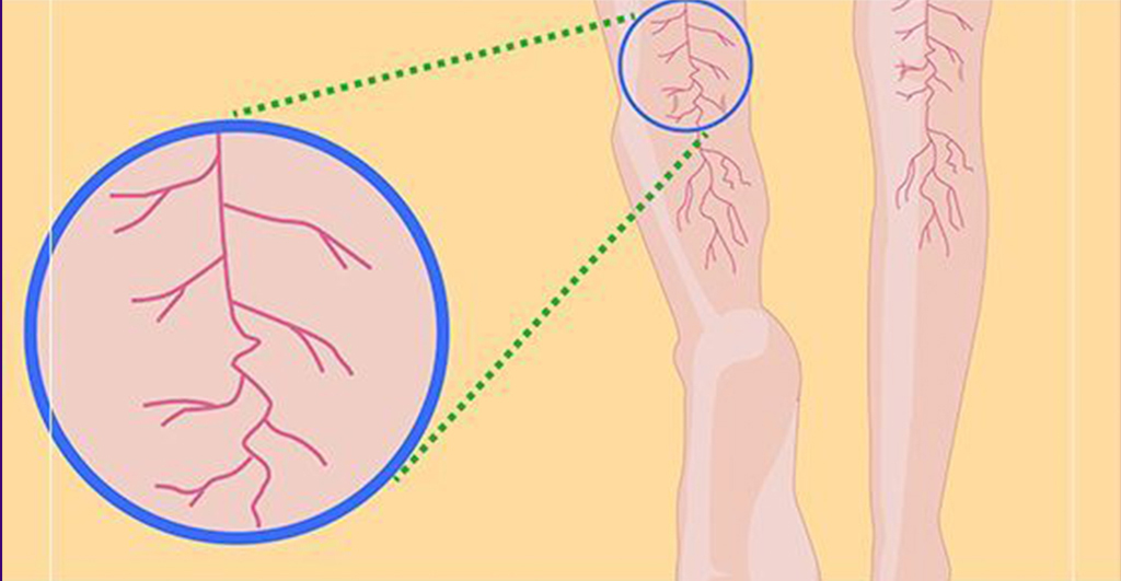 Vücudunuzda Magnezyum Eksikliğinin 13 Belirtisi - 3