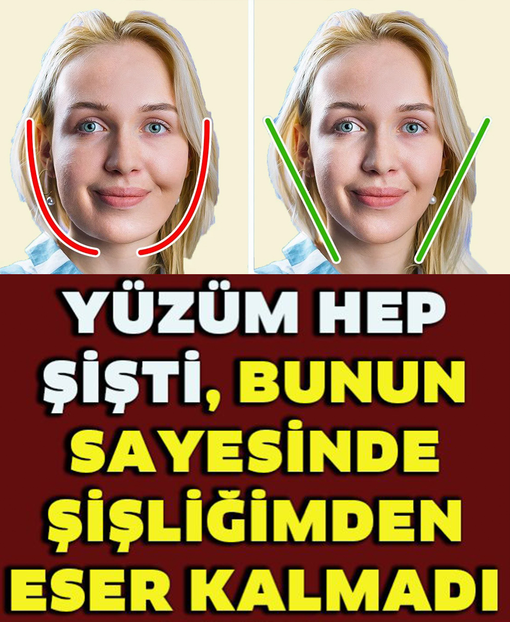 Şiş ve Kabarık Bir Yüzden Kurtulmanın Yolları - 1